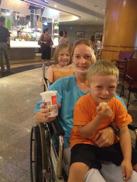 Sometimes bad Things Happen | The Gap Year Family My wife in recovery after being hit by a moped in Vietnam.